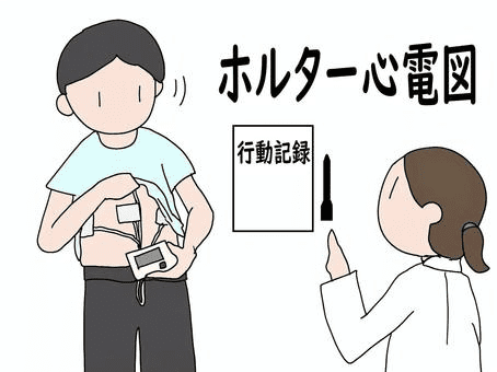 24時間ホルター検査のイメージ